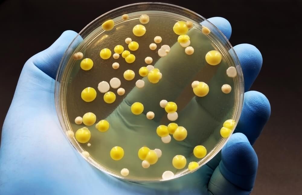 Superbug